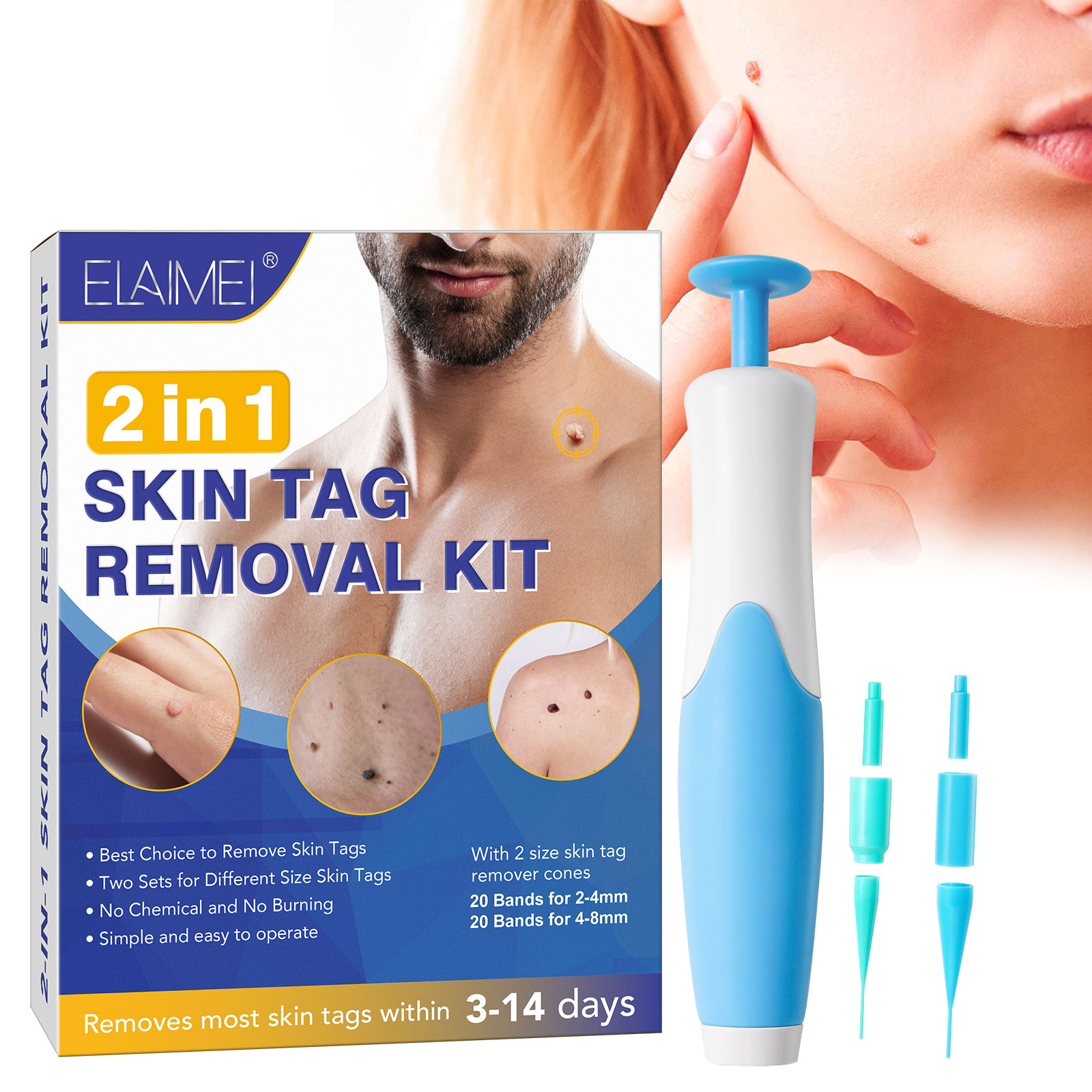 Skin Tag Removal Kit - Image 2
