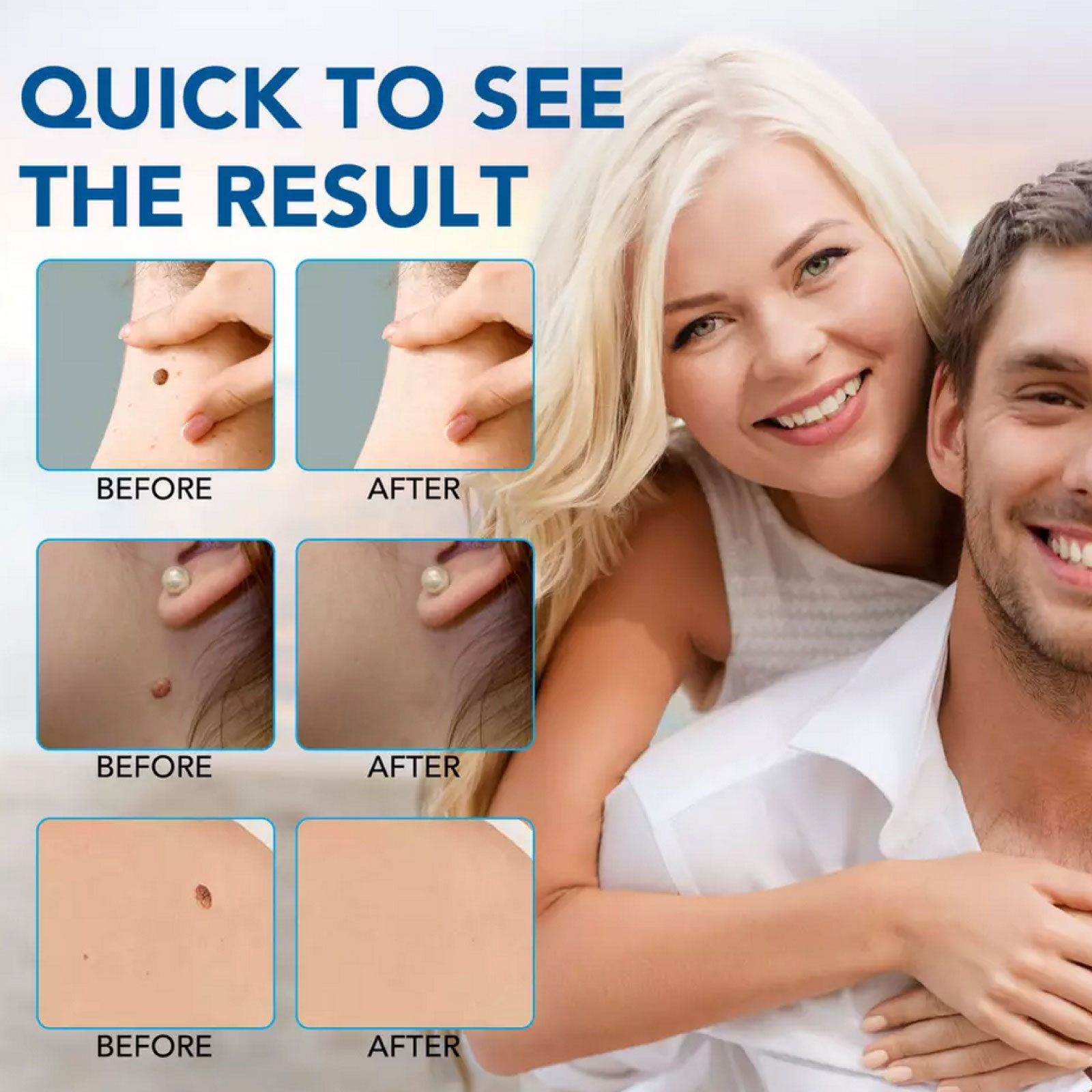 Skin Tag Removal Kit - Image 3