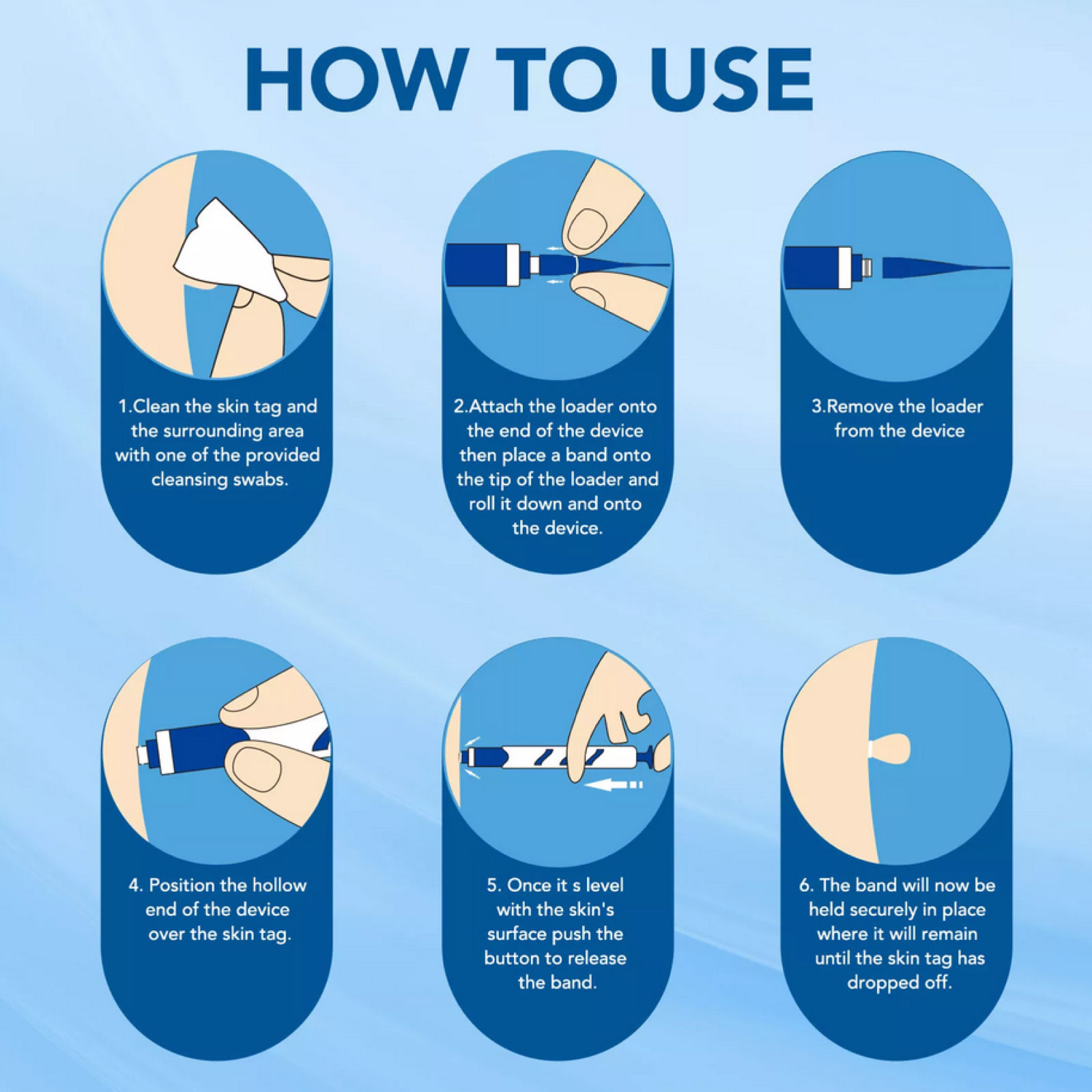 Skin Tag Removal Kit - Image 4